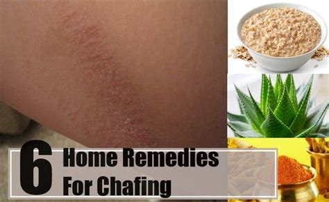 6 Chafing Home Remedies Natural Treatments And Cure Home Remedies