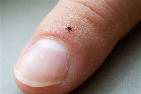 Ticks Tickborne Disease Minnesota Dept Of Health