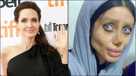 Teen Undergoes Whopping 50 Surgeries To Look Like Angelina Jolie
