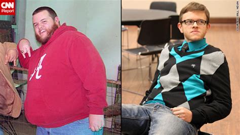 Fearing Scary Diagnosis Man Drops 175 Pounds