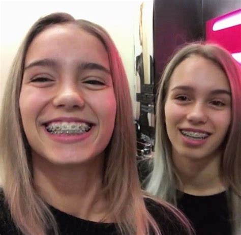 Lisa And Lena Lisa And Lena Braces Girls Braces Girl