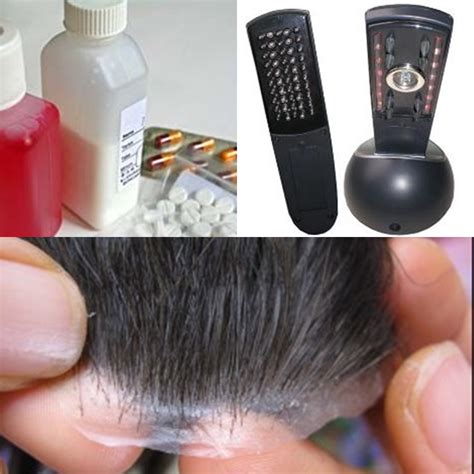 Home remedies for hair fall for men and women 1. Natural Hair Loss Treatments - The Non-surgical Ways