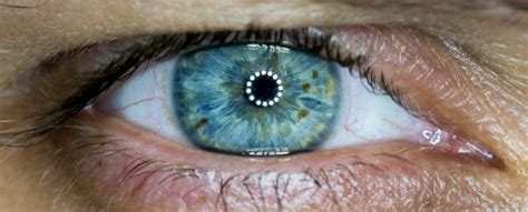 Gene Therapy Partially Restores Vision In Blind Patient In First Case