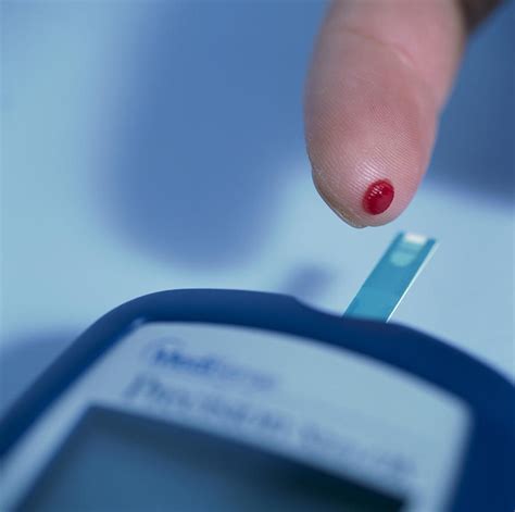 Blood Glucose Testing Photograph By Cristina Pedrazzini Fine Art America