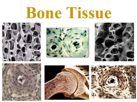 Bone Tissue