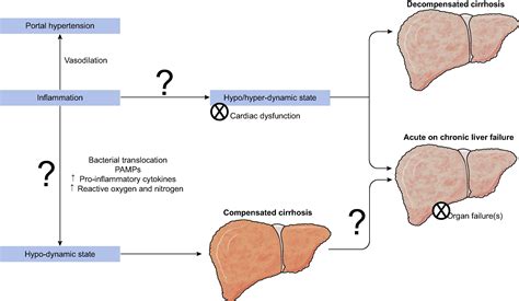 Pathophysiology Of Cirrhosis Of Liver My XXX Hot Girl