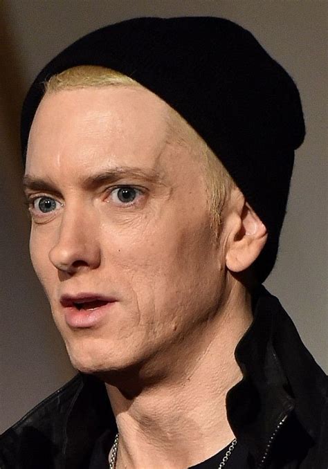 Eminems New Looks And The Riddle Of Plastic Surgery