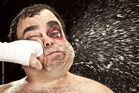 Black Eye Wound Boxer Spit Due Big Punch Hit Portrait Stock Photo Adobe Stock