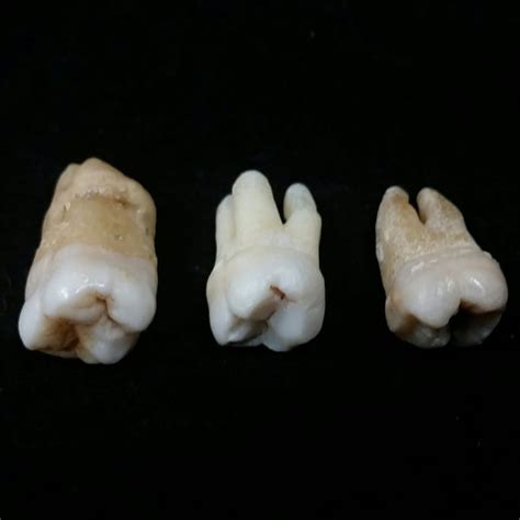 Human Teeth Molars Skullstore