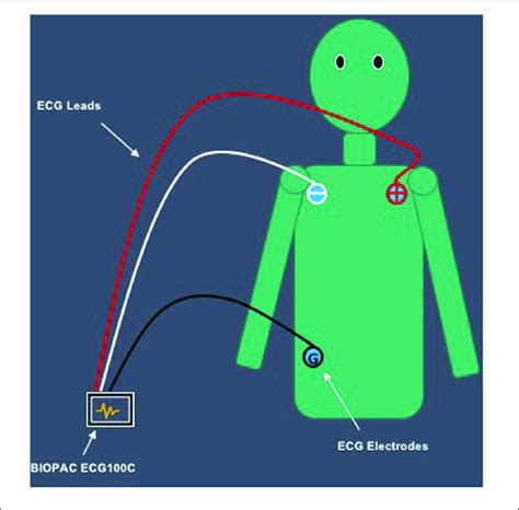Placement Of Ecg Electrodes On Participants Body