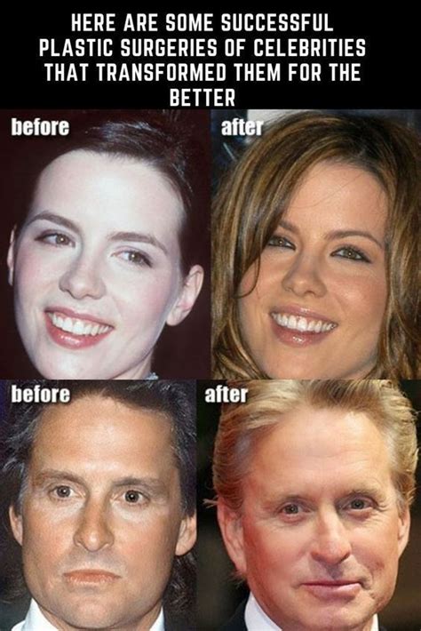 Here Are Some Successful Plastic Surgeries Of Celebrities That