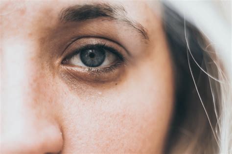 5 Reasons For Saggy And Heavy Eye Bags And Rituals To Get Rid Of Them