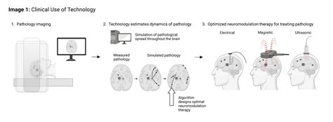 Pathology Modifying Neuromodulation Therapy Design Explore Technologies