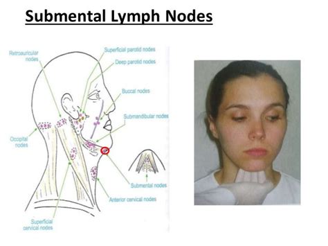 Lymph Nodes Diagram Face