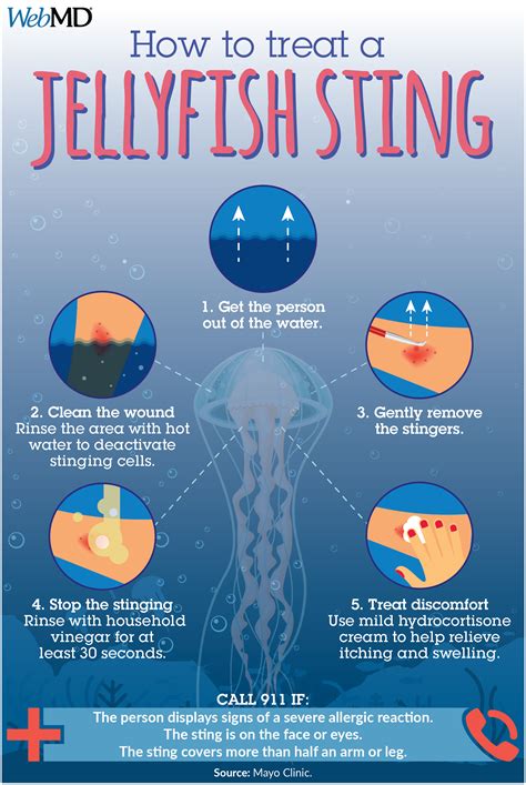 Jellyfish Stings Treatment Jellyfish Sting Jellyfish Jellyfish Facts