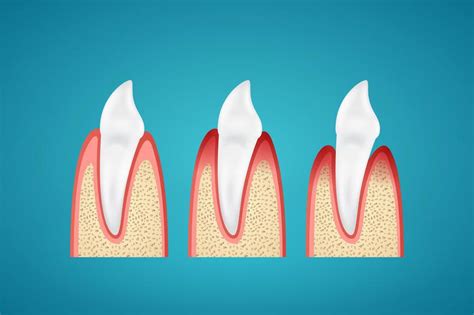 Scary Side Effects Of Gum Disease Tompkins Dental General Dentistry