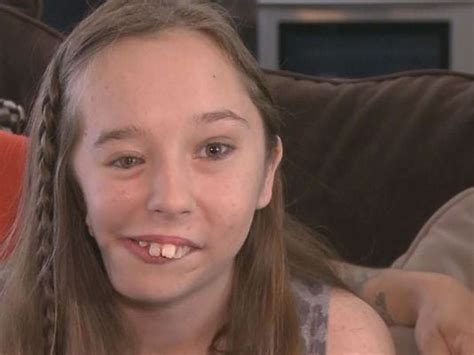 Teen With Facial Deformity Finds Reason To Smile