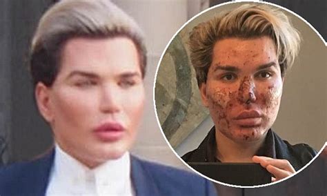Human Ken Doll Rodrigo Alves Shows Off His New Look Daily Mail Online