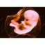 8 Week Human Fetus  Stock Image C022/0547 Science Photo Library