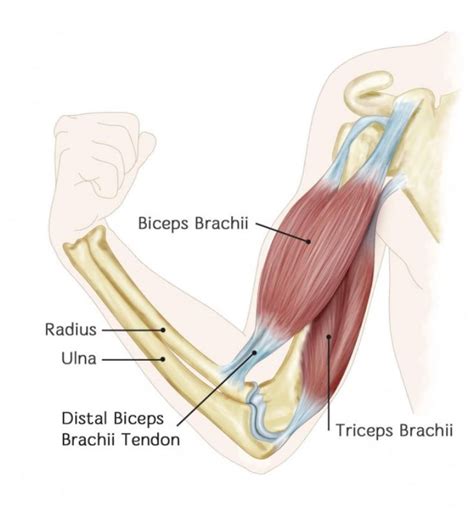 Distal Biceps Tendon Tear Dr Edward Weldon