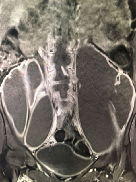 Radiology Imaging Mri Spines X Ray Gaga Cases Abstract Artwork