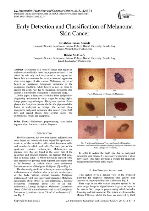 Pdf Early Detection And Classification Of Melanoma Skin Cancer
