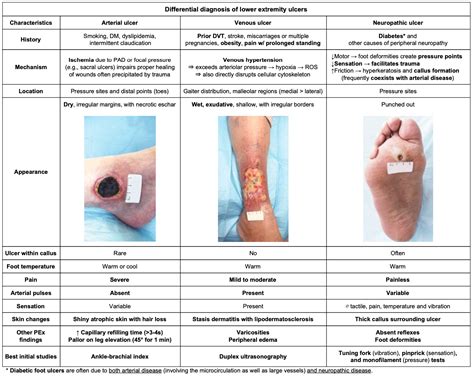 Table Summary OC Differentiating Major Causes Of Chronic Ulcers R