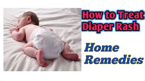 How To Treat Baby Diaper Rash Home Remedies For Diaper Rash Healthy