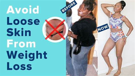 How To Avoid Loose Skin DURING And AFTER Weight Loss Skin Removal