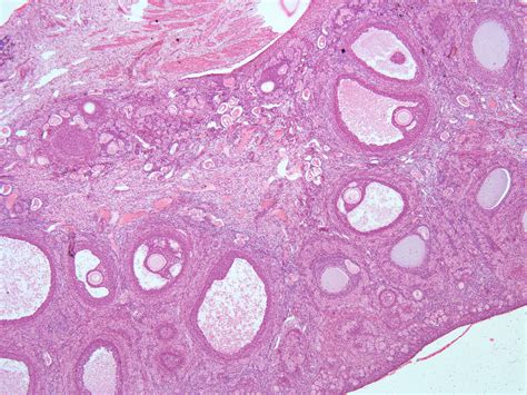 Ovary From Cat 40 X