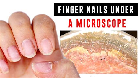 Dirt Under Fingernails Microscope Micropedia