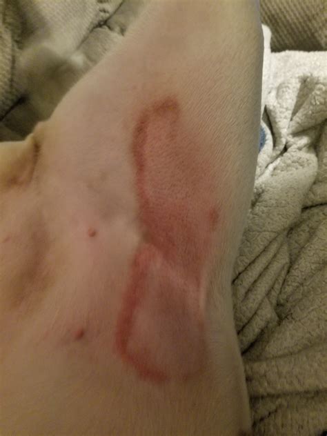 My Dog Has A Red Rash On Her Lower Stomach Between Her Leg I Was Going