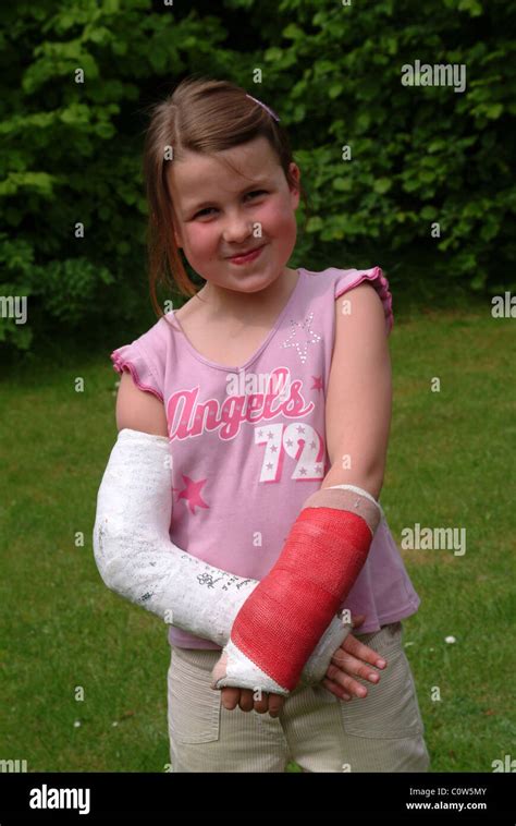 Little Girl With Two Broken Arms Stock Photo Alamy
