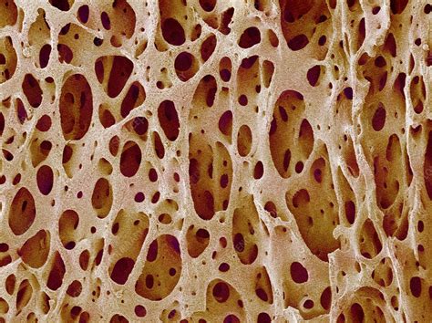 Bone Tissue Stock Image P1050180 Science Photo Library