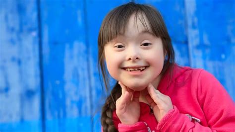 Perbedaan Autis Dan Down Syndrome Apotek Hidup