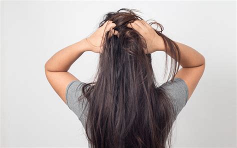 Itchy Scalp And Hair Loss What Is The Relation Between Them Skinkraft