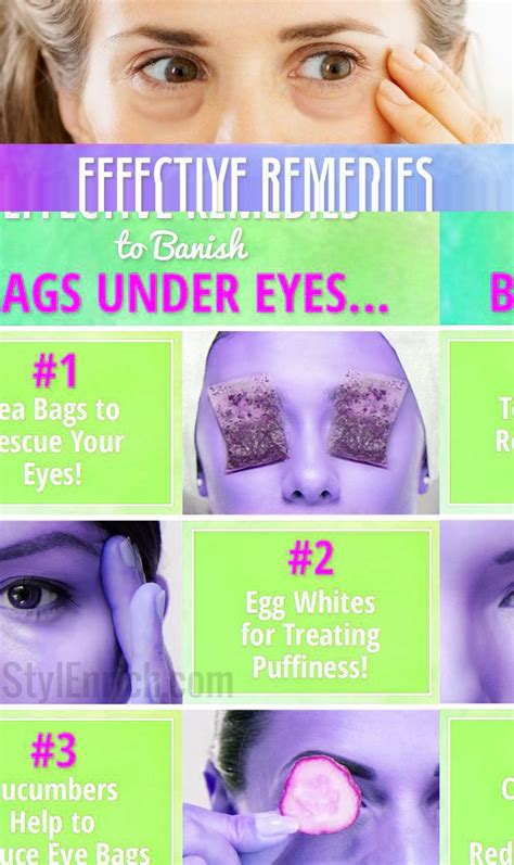 How To Get Rid Of Eye Bags Effective Remedies To Banish Puffy Eyes
