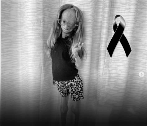 Muere Adalia Rose Williams A Los 15 Años Youtuber Que Vivía Con Progeria Canal 66