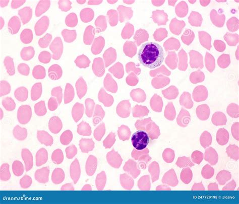 Human Blood Smear Lymphocyte And Monocyte Stock Photo Image Of Blood