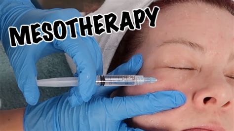 Mesotherapy Facial Anti Aging Treatment Youtube