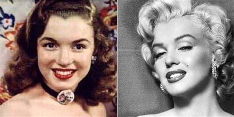 Hollywood Stars Before And After Plastic Surgery