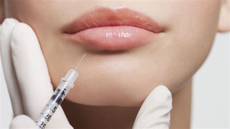 el abc de los rellenos de labios todo lo que hay que saber sobre uno de los tratamientos más