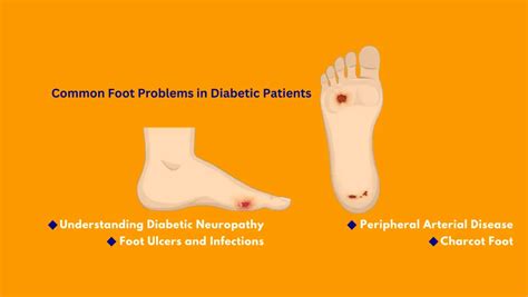 Common Foot Problems In Diabetic Patients Prevention And Care