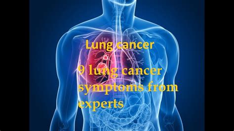 9 Lung Cancer Symptoms From Experts Youtube