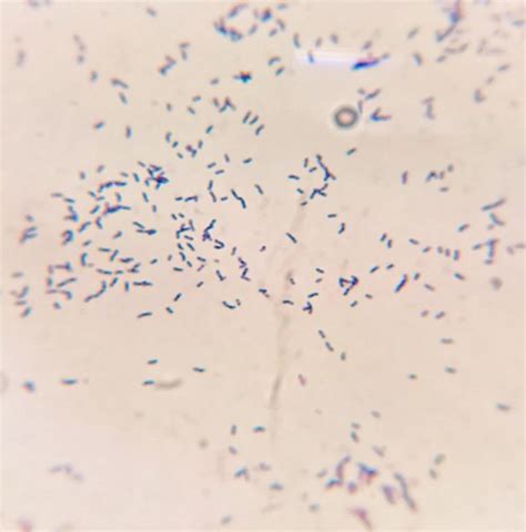 Bifidobacterium Adolescentis Microbestiary
