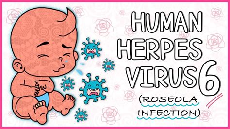 Human Herpes Virus 6 Roseola Infantum All You Need To Know Youtube