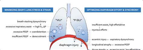 Principles Of Lung And Diaphragm Protective Ventilation Δp Change In