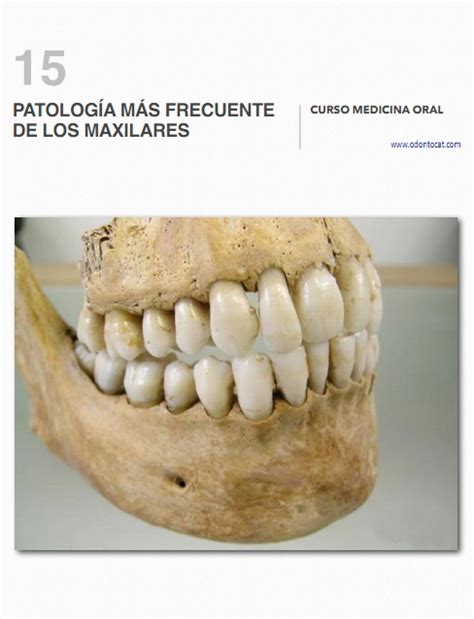 Odontocat Curso Online De Medicina Oral