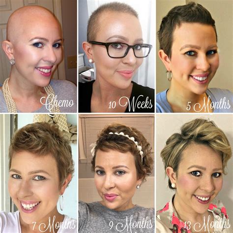 Hair is an integral part of how we define ourselves and to go without it. Post-Chemo Hair Growth & Styling Tips | Hair growth stages, Hair growth after chemo, 1 year hair ...