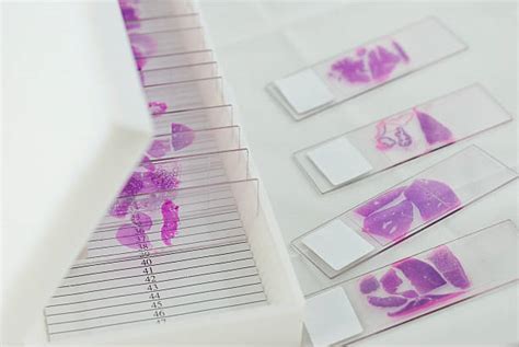 Histology Slides Stock Photos Pictures And Royalty Free Images Istock